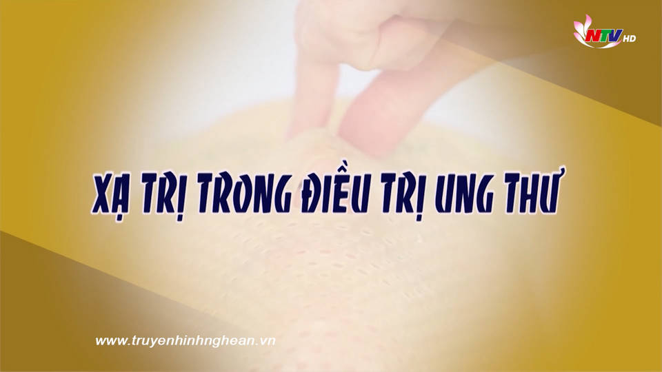 Xạ trị trong điều trị ung thư