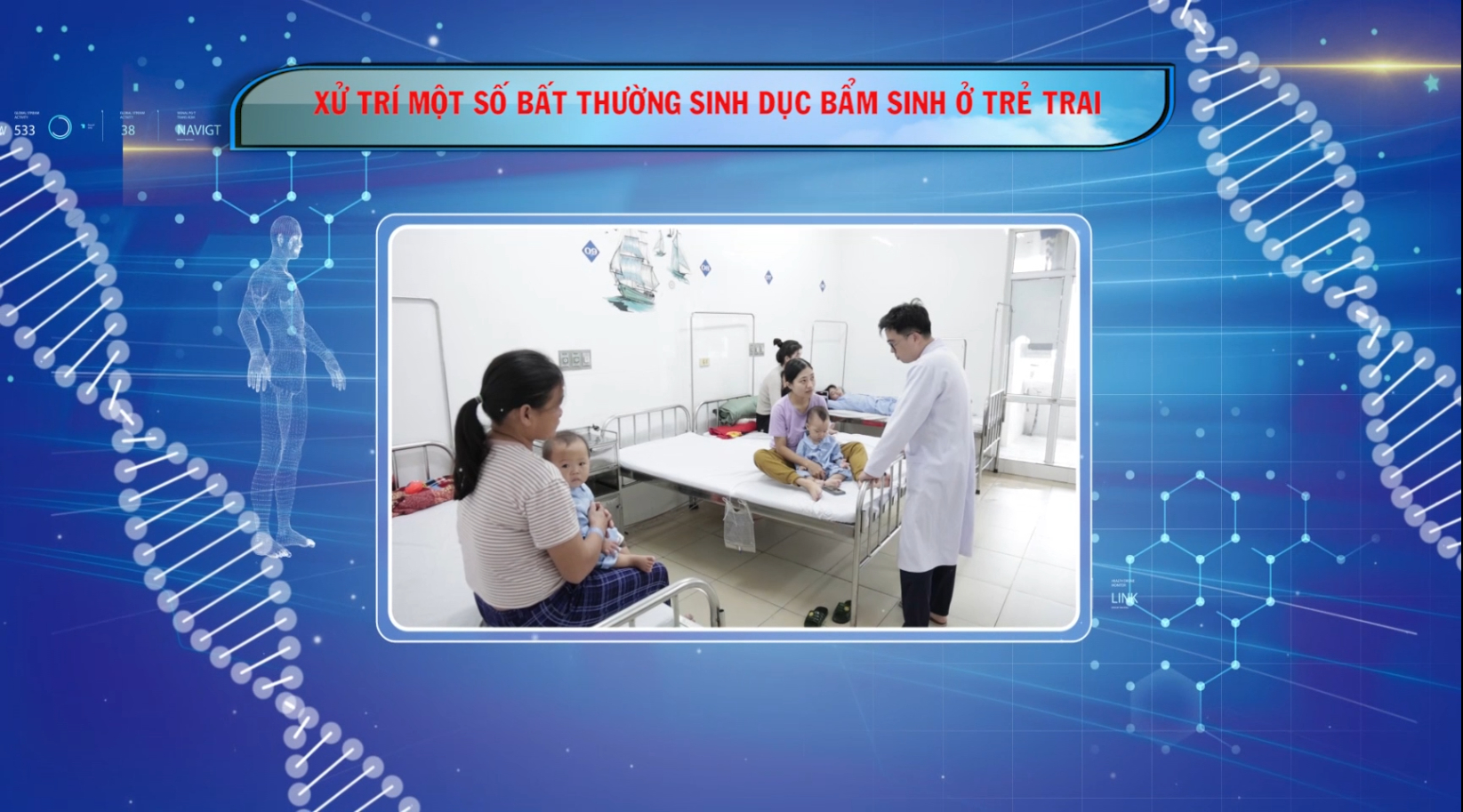 Sức khỏe của bạn: Xử trí một số bất thường sinh dục bẩm sinh ở trẻ em
